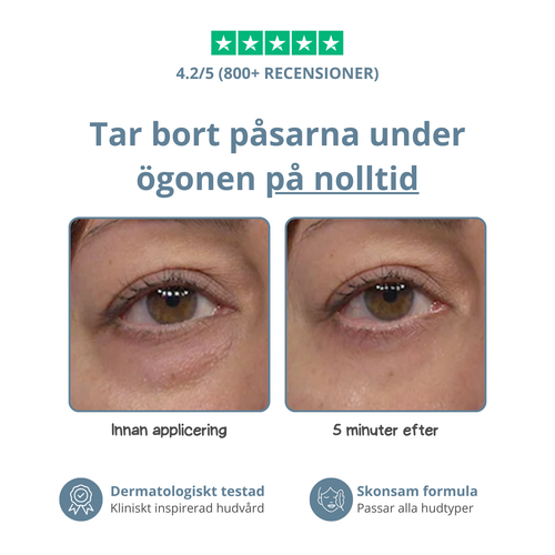 SkinSnap™ – Säg hejdå till påsar och rynkor på minuter