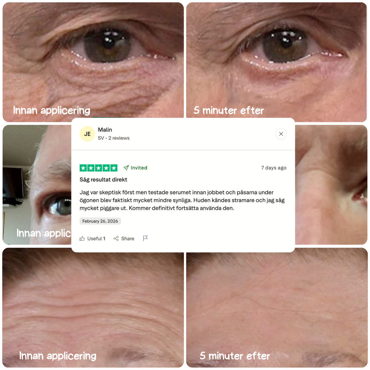 SkinSnap™ – Säg hejdå till påsar och rynkor på minuter